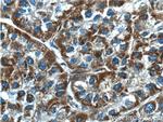 NDUFB5 Antibody in Immunohistochemistry (Paraffin) (IHC (P))