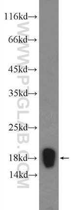 NDUFB5 Antibody in Western Blot (WB)
