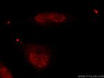 USP39 Antibody in Immunocytochemistry (ICC/IF)