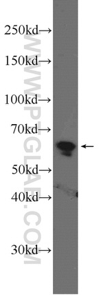USP39 Antibody in Western Blot (WB)