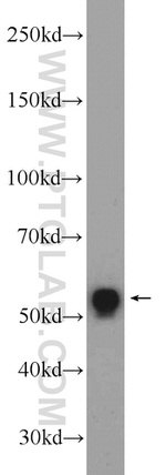 USP39 Antibody in Western Blot (WB)