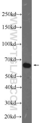 USP39 Antibody in Western Blot (WB)
