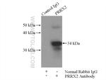 PRRX2 Antibody in Immunoprecipitation (IP)