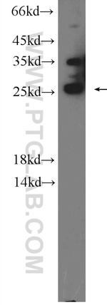 PRRX2 Antibody in Western Blot (WB)