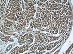 MRPL33 Antibody in Immunohistochemistry (Paraffin) (IHC (P))