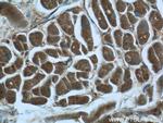 MRPL33 Antibody in Immunohistochemistry (Paraffin) (IHC (P))