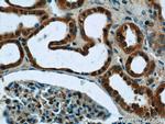 MRPL33 Antibody in Immunohistochemistry (Paraffin) (IHC (P))