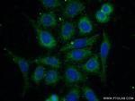 PPP2R5E Antibody in Immunocytochemistry (ICC/IF)
