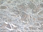 PPP2R5E Antibody in Immunohistochemistry (Paraffin) (IHC (P))
