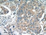PPP2R5E Antibody in Immunohistochemistry (Paraffin) (IHC (P))