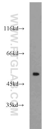 PPP2R5E Antibody in Western Blot (WB)