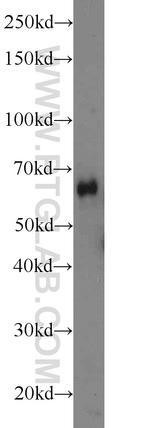 ODF2L Antibody in Western Blot (WB)