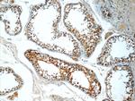 CEP55 Antibody in Immunohistochemistry (Paraffin) (IHC (P))