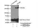 ATAD2 Antibody in Immunoprecipitation (IP)