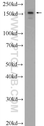 ATAD2 Antibody in Western Blot (WB)