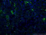 MME/CD10 Antibody in Immunohistochemistry (PFA fixed) (IHC (PFA))