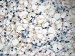 CTGF Antibody in Immunohistochemistry (Paraffin) (IHC (P))