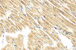 CTGF Antibody in Immunohistochemistry (Paraffin) (IHC (P))