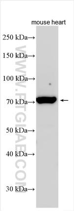 CTGF Antibody in Western Blot (WB)