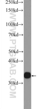 AKR1D1 Antibody in Western Blot (WB)