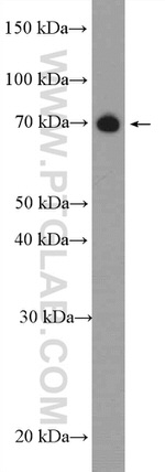 SOLO Antibody in Western Blot (WB)