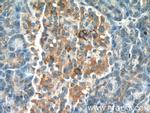FAM158A Antibody in Immunohistochemistry (Paraffin) (IHC (P))