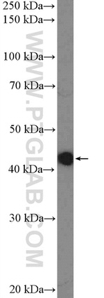 ZNF572 Antibody in Western Blot (WB)