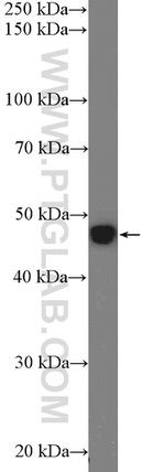 ZNF572 Antibody in Western Blot (WB)