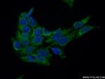 MOK Antibody in Immunocytochemistry (ICC/IF)