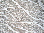 MOK Antibody in Immunohistochemistry (Paraffin) (IHC (P))