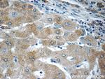 MOK Antibody in Immunohistochemistry (Paraffin) (IHC (P))