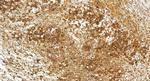 RNF146 Antibody in Immunohistochemistry (Paraffin) (IHC (P))
