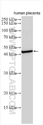 RNF146 Antibody in Western Blot (WB)