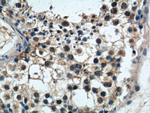PRPF6 Antibody in Immunohistochemistry (Paraffin) (IHC (P))