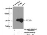 PRPF6 Antibody in Immunoprecipitation (IP)