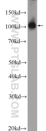 PRPF6 Antibody in Western Blot (WB)