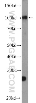 PRPF6 Antibody in Western Blot (WB)