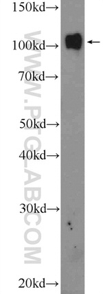 PRPF6 Antibody in Western Blot (WB)