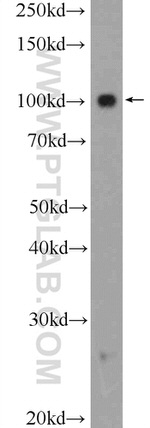 PRPF6 Antibody in Western Blot (WB)