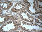 LY6H Antibody in Immunohistochemistry (Paraffin) (IHC (P))