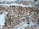 LY6H Antibody in Immunohistochemistry (Paraffin) (IHC (P))
