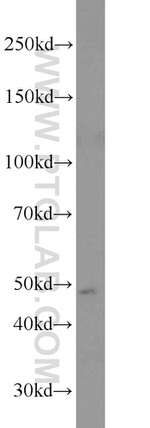 GFAP Antibody in Western Blot (WB)