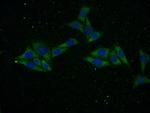 CTGF Antibody in Immunocytochemistry (ICC/IF)