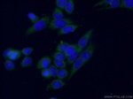 CTGF Antibody in Immunocytochemistry (ICC/IF)