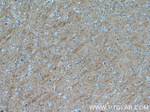 CTGF Antibody in Immunohistochemistry (Paraffin) (IHC (P))