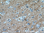 CTGF Antibody in Immunohistochemistry (Paraffin) (IHC (P))