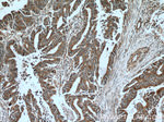 CTGF Antibody in Immunohistochemistry (Paraffin) (IHC (P))