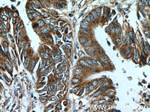 CTGF Antibody in Immunohistochemistry (Paraffin) (IHC (P))