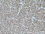 CTGF Antibody in Immunohistochemistry (Paraffin) (IHC (P))