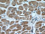 CTGF Antibody in Immunohistochemistry (Paraffin) (IHC (P))